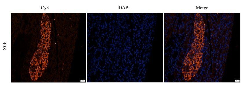 SCG2 Rabbit Polyclonal Antibody