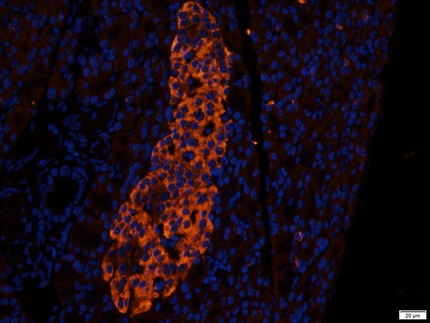 SCG2 Rabbit Polyclonal Antibody
