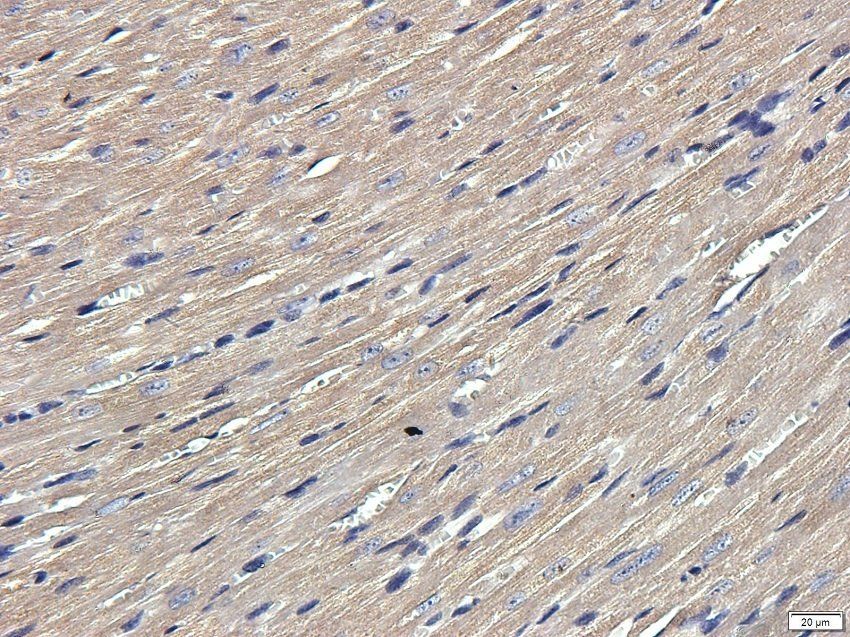 TYRP1 Rabbit Polyclonal Antibody