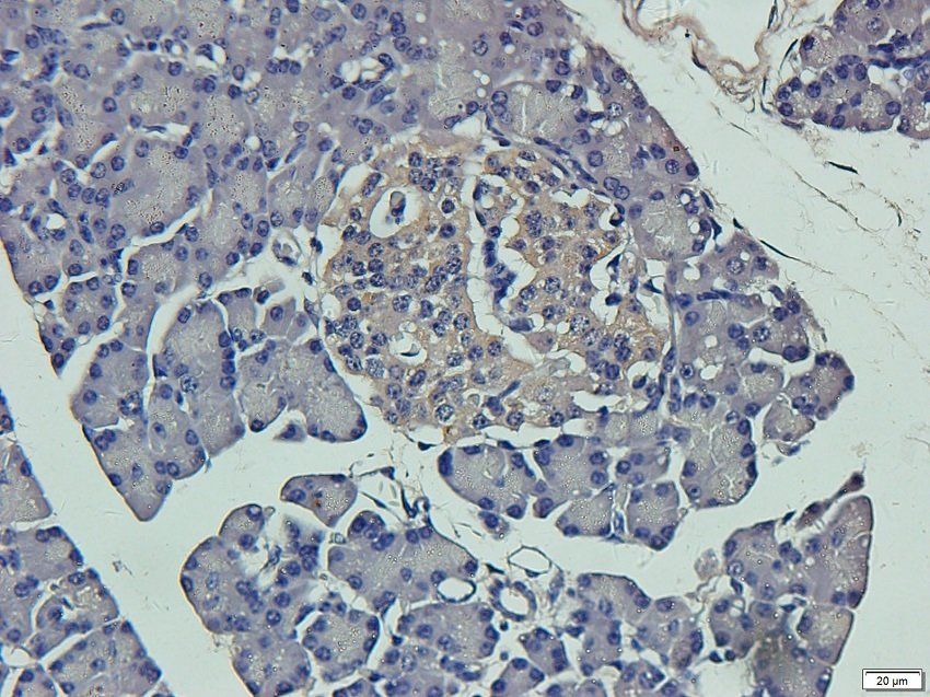 TYRP1 Rabbit Polyclonal Antibody