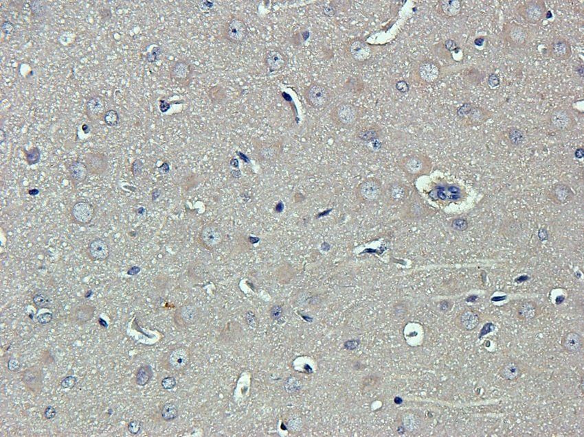 TYRP1 Rabbit Polyclonal Antibody