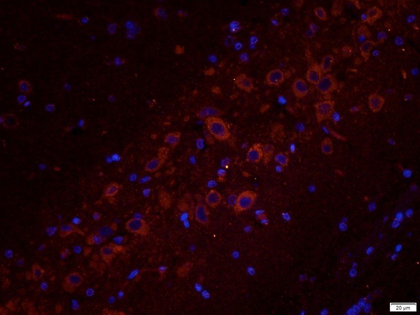 TYRP1 Rabbit Polyclonal Antibody