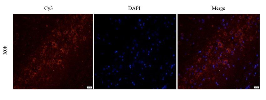 TYRP1 Rabbit Polyclonal Antibody