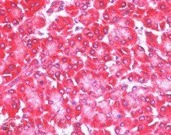 4E-T/EIF4ENIF1 Antibody