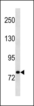 STAT3 Antibody (N-term)