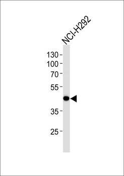 AIM2 Antibody
