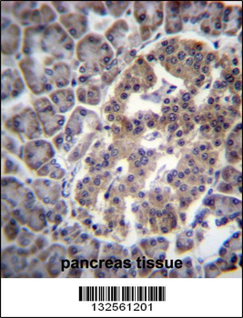 DNAJC14 Antibody (Center)