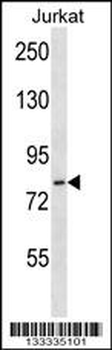 HJURP Antibody (C-term)