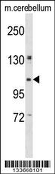 KIF5B Antibody (C-term)