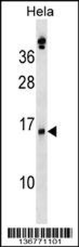 SLPI Antibody (Center)