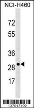 VDAC3 Antibody (Center)