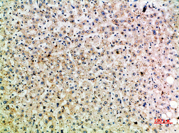 HSP 75 Polyclonal Antibody