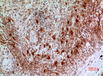CD200 Polyclonal Antibody