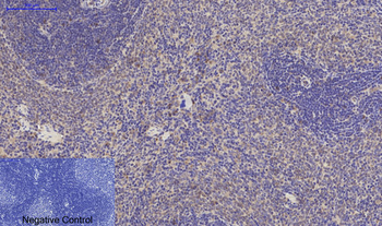 Jagged1 Polyclonal Antibody