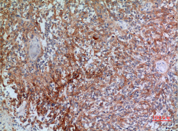 CGREF1 Polyclonal Antibody