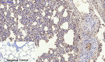 Nrf2 Polyclonal Antibody
