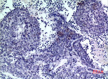 PDGF-D Polyclonal Antibody