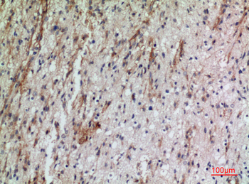 CD160 Polyclonal Antibody