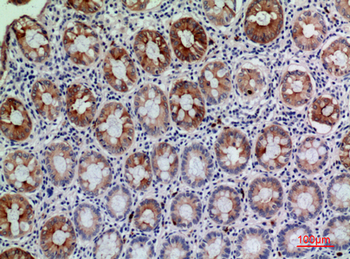 CD177 Polyclonal Antibody