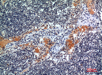 CD116 Polyclonal Antibody