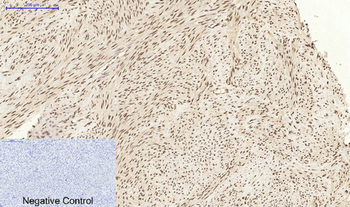 Caspase-3 Polyclonal Antibody