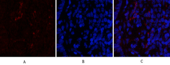 Cdk4 Polyclonal Antibody