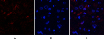 MDM2 Polyclonal Antibody