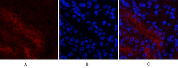 Mcl-1 Polyclonal Antibody