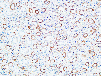 TNF-R1 Polyclonal Antibody