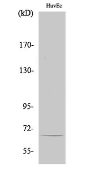 TBX15/18 Polyclonal Antibody