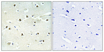 S-100A16 Polyclonal Antibody