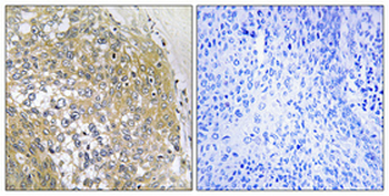 S-100A16 Polyclonal Antibody