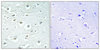 RoXaN Polyclonal Antibody
