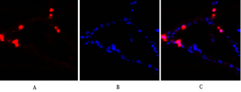 PKC Polyclonal Antibody