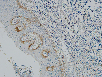 Pax-8 Polyclonal Antibody