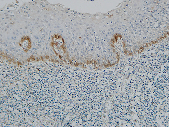 Pax-8 Polyclonal Antibody