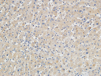 p15 Polyclonal Antibody