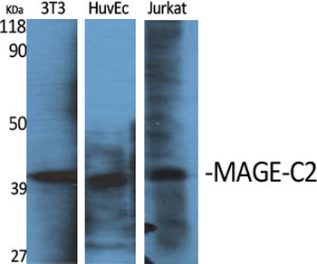 MAGE-C2 Polyclonal Antibody