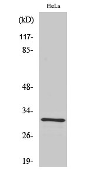 IL-1β Polyclonal Antibody