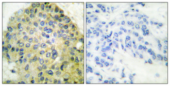 IKKβ Polyclonal Antibody