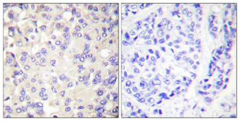 IKKβ Polyclonal Antibody