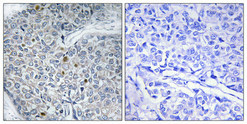 HoxD12 Polyclonal Antibody