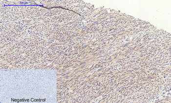 GSK3β Polyclonal Antibody