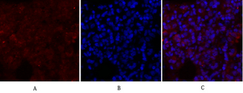 Glut1 Polyclonal Antibody