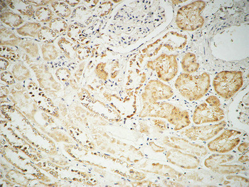 Fhit Polyclonal Antibody