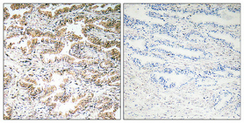 Calcitonin Polyclonal Antibody