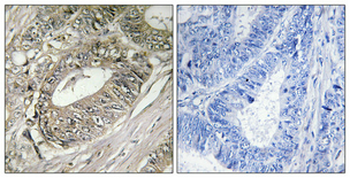 BIG2 Polyclonal Antibody