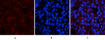 CaMKIIβ/γ/δ (phospho Thr287) Polyclonal Antibody