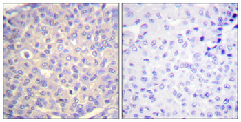 Synaptotagmin 1/2 (phospho Ser309/306) Polyclonal Antibody