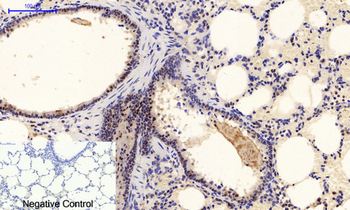 ERK 1/2 (phospho Tyr222/205) Polyclonal Antibody